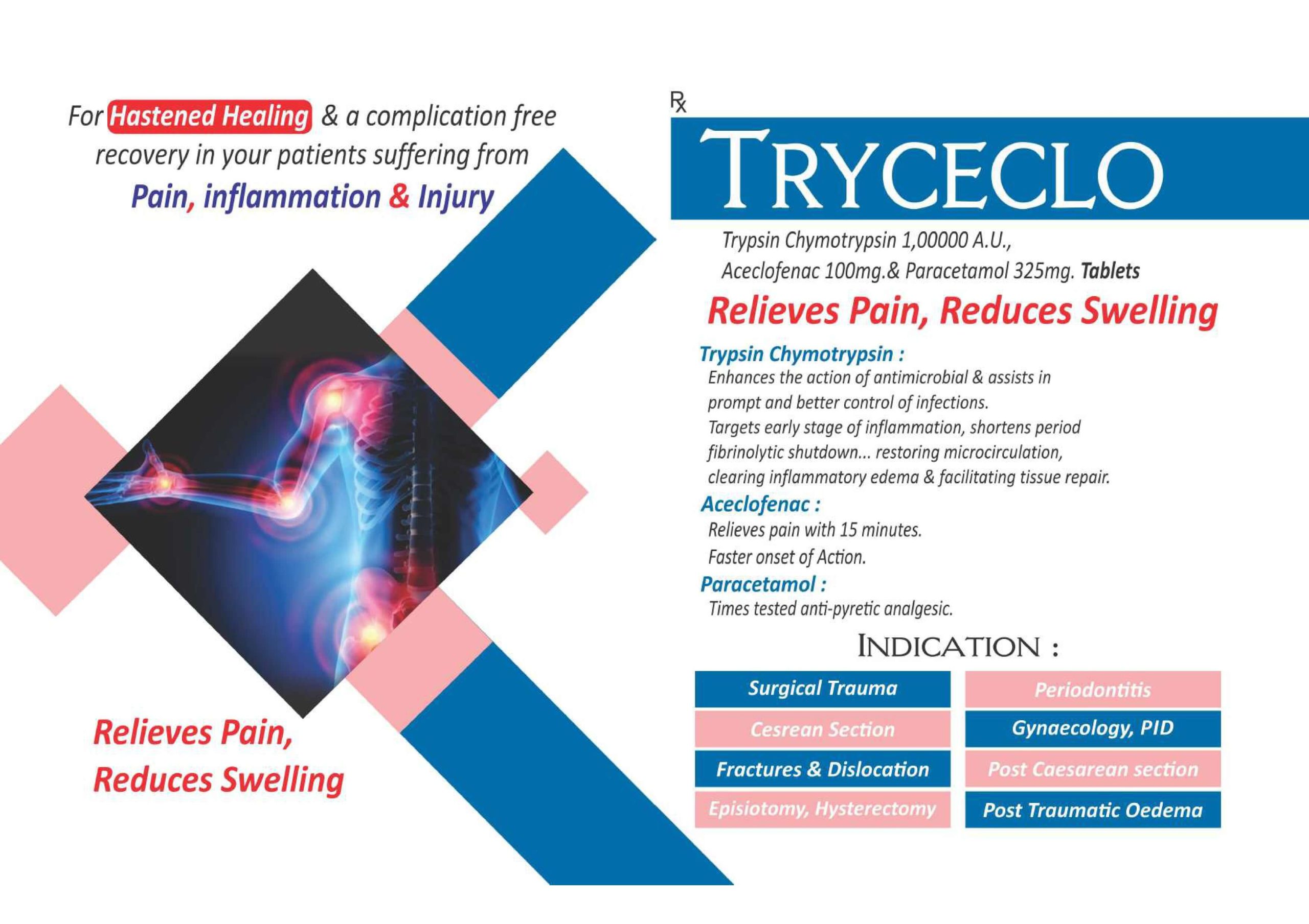 Tryceclo